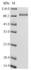 Protein Mdm4 (MDM4), human, recombinant