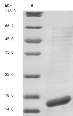 Calcium-activated potassium channel subunit alpha-1 (KCNMA1), partial, human, recombinant