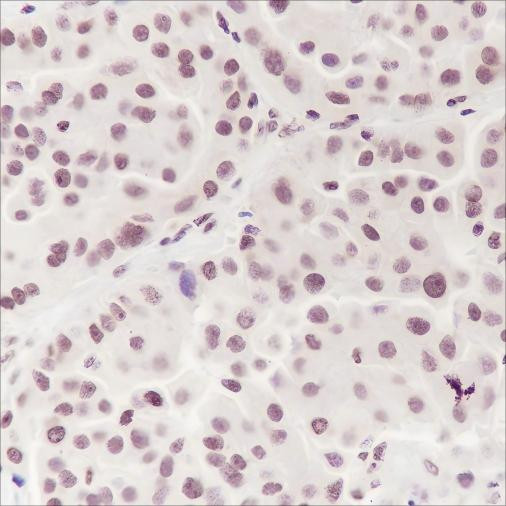 Anti-Recombinant Ataxin-3, clone A135