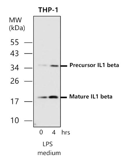 Anti-IL1 beta