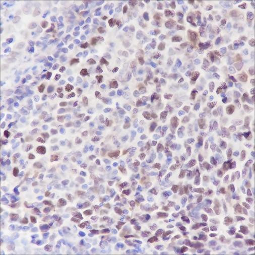 Anti-Recombinant MCM5, clone A301