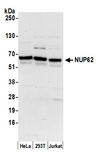 Anti-Nucleoporin p62/NUP62