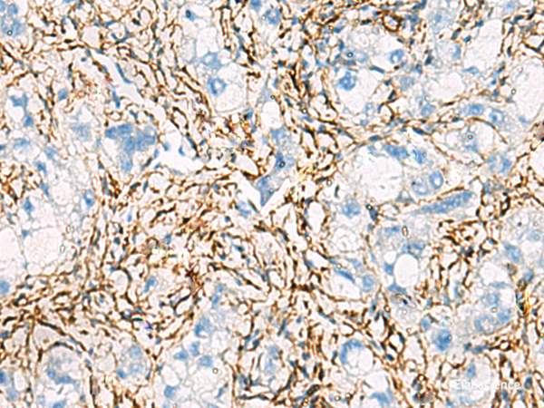 Anti-ACTC1