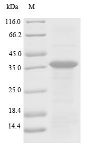 Plasminogen (PLG), partial, human, recombinant