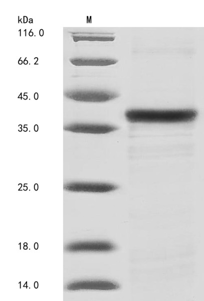 Tenomodulin (Tnmd), partial, mouse, recombinant