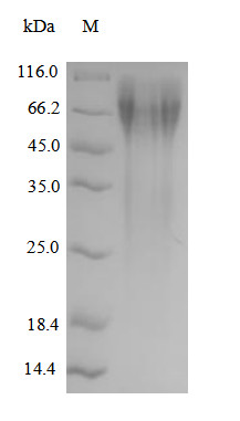 Nuclear receptor subfamily 4 group A member 2 (NR4A2), human, recombinant