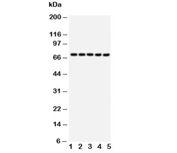 Anti-HSP70