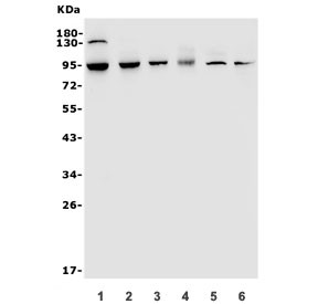 Anti-TRPV2