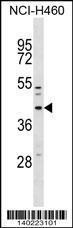 Anti-MFF, ID (MFF, C2orf33, Mitochondrial fission factor)