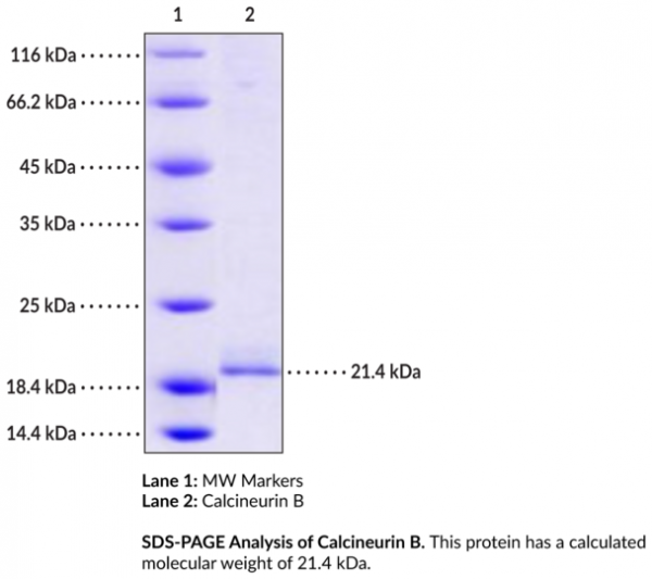 Calcineurin B (human, recombinant)