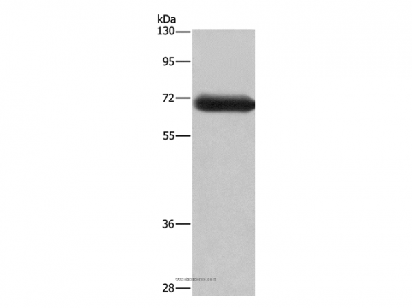 Anti-DPYSL3