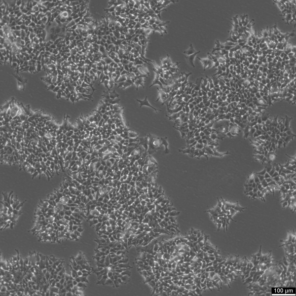 2V6.11 Cells