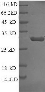 Tissue factor pathway inhibitor (TFPI), rabbit, recombinant