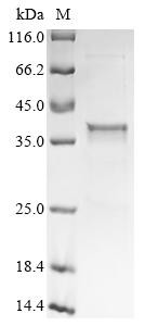 Ectonucleotide pyrophosphatase/phosphodiesterase family member 1 (Enpp1), partial, mouse, recombinan