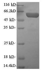 Serum paraoxonase/arylesterase 1 (PON1), human, recombinant