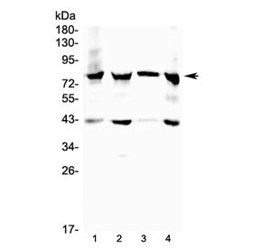 Anti-17-beta-Hydroxysteroid dehydrogenase 4 (HSD17B4)