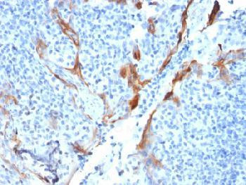 Anti-Cytokeratin 16 (KRT16) (Suprabasal Keratinocyte Marker) Recombinant Mouse Monoclonal Antibody (