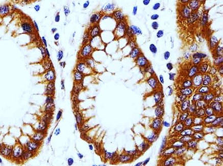 Anti-Calpain 2, clone 1381CT669.7.66.71