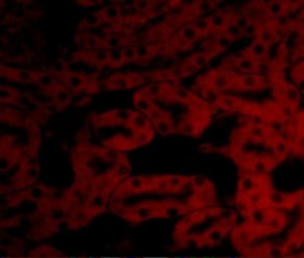 Anti-Bcl 2A1
