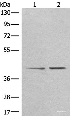 Anti-TMEM248