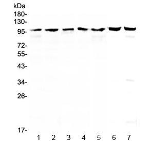 Anti-TOP1 / Topoisomerase I