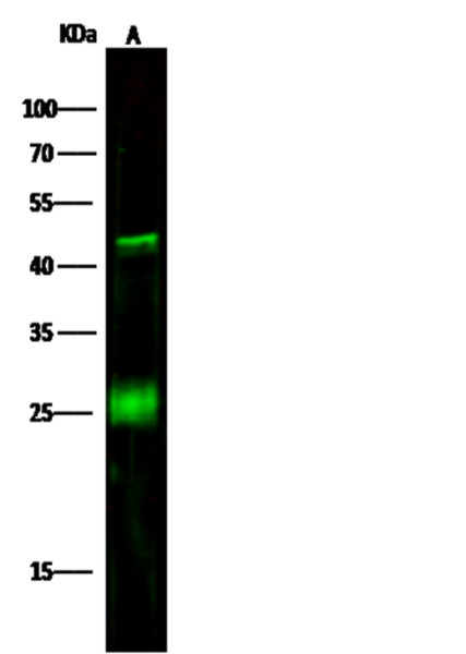 Anti-CD3d/CD3 delta Monoclonal Recombinant Antibody