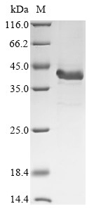Complement C4-B (C4b), partial, mouse, recombinant