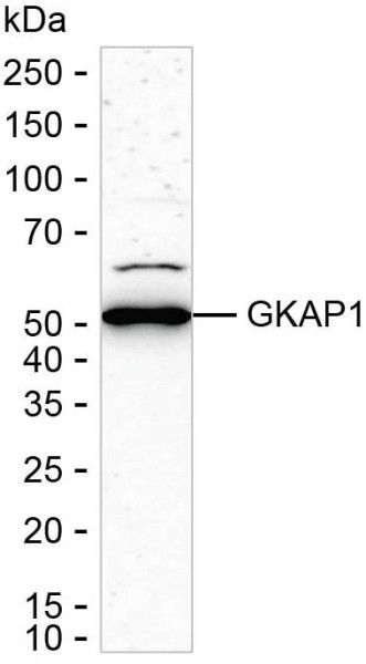 Anti-GKAP1