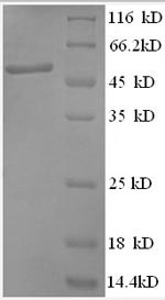 Anaphase-promoting complex subunit 5 (ANAPC5), partial, human, recombinant