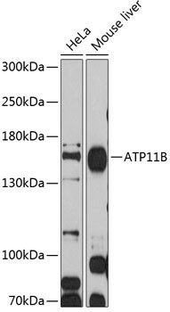 Anti-ATP11B