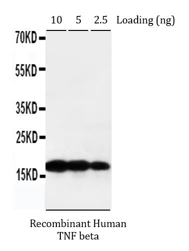 Anti-Lymphotoxin alpha / TNF beta