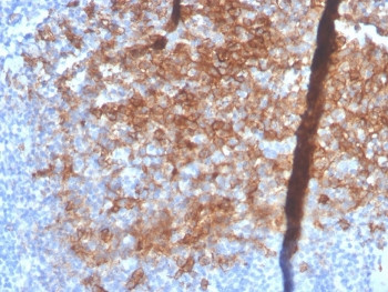 Anti-Syndecan-1 / CD138, clone SDC1/4378R