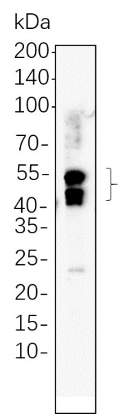 Anti-Recombinant LEF1, clone 10F14
