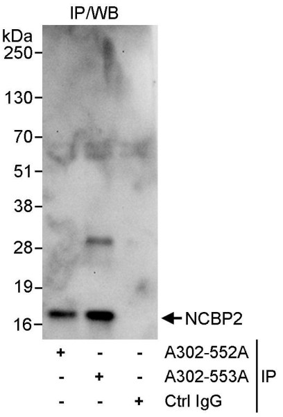 Anti-NCBP2