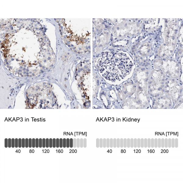 Anti-AKAP3