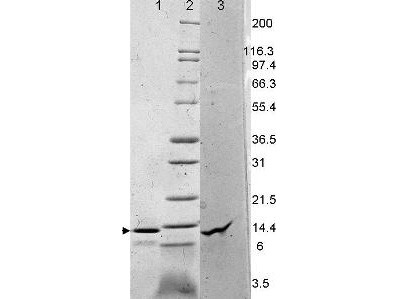 Leptin, human recombinant