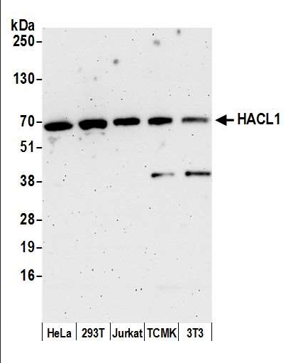 Anti-HACL1