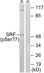 Anti-Phospho-SRF (Ser77)