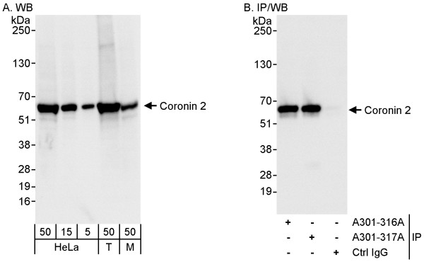 Anti-Coronin 2