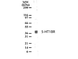 Anti-Serotonin Receptor 1B