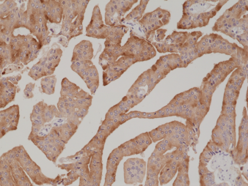 Anti-PSA (human), Rabbit Monoclonal (RM323) (Biotin)