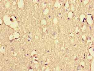 Anti-EHD3