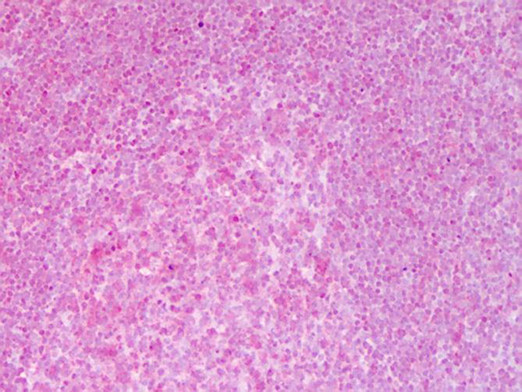 Anti-NFKB p65 (Rel A)