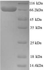 Cholinesterase (BCHE), human, recombinant