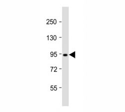 Anti-Dnmt3b