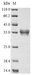 Matrix protein (M), human metapneumovirus, recombinant