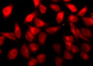 Anti-STAT4