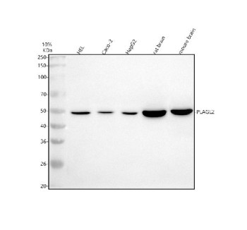 Anti-PLAGL2 / Pleiomorphic adenoma gene-like 2