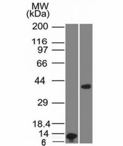 Anti-Arginase 1, clone ARG1/1125