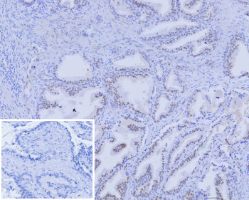 Anti-Androgen Receptor, clone r2F12